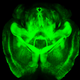 Illustration for article titled Are We About to Cross the Blood-Brain Barrier, and Transform Medicine?